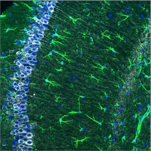 Hippocampal CA1 subregion stained for neurons and astrocytes