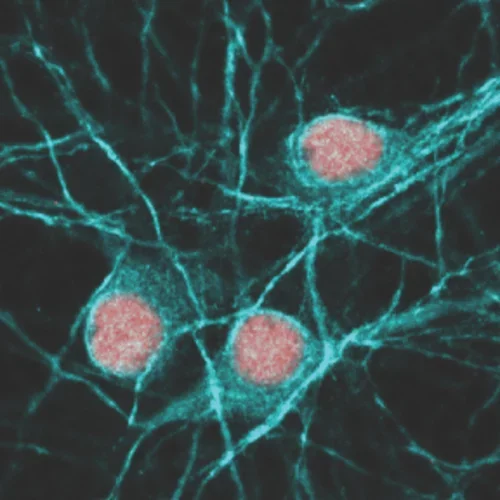 cultured hippocampal neurons stained for neurites and nuclei